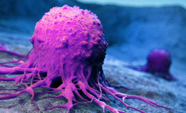 O Fuxico: Câncer de Pele: Entenda a doença de Marília Gabriela