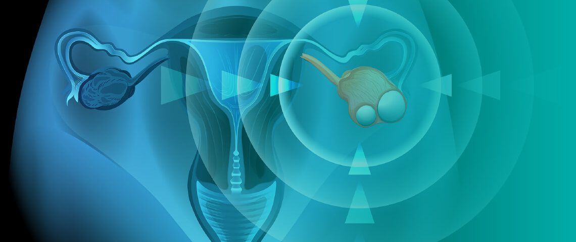 SOC1 study found significant gains in ovarian cancer treatment with salvage therapy