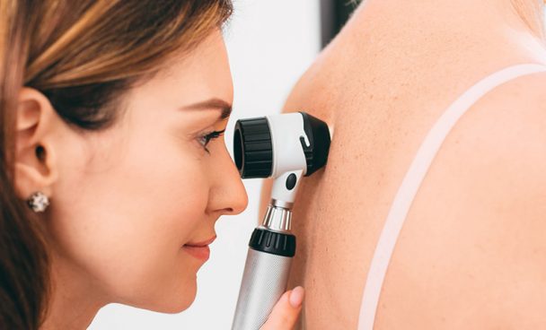 Non-melanoma skin cancer