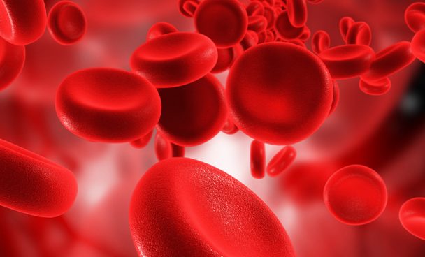 Myelodysplastic Syndrome