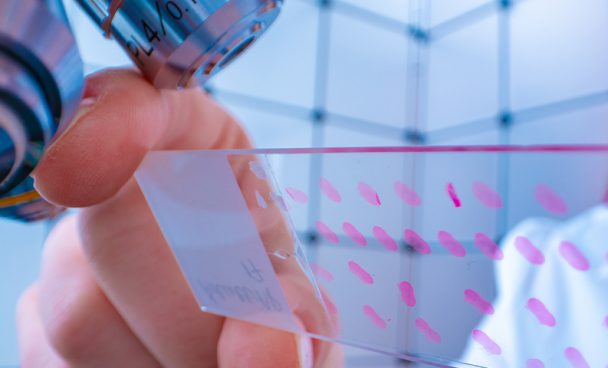 Unknown primary site