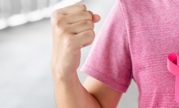 Hormonioterapia de Câncer de Mama