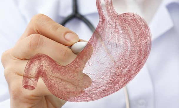 Cirurgia do Estômago