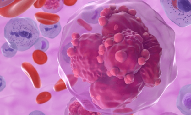 O Globo: Entenda o que é mieloma múltiplo, câncer que matou a jornalista Cristiana Lôbo