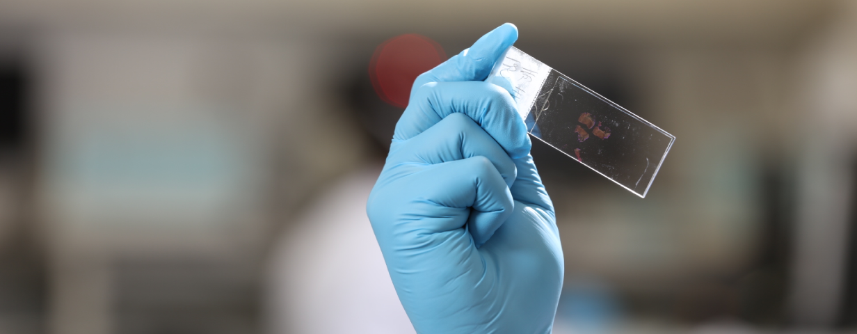 OC MEDICINA DE PRECISÃO IRA LAB