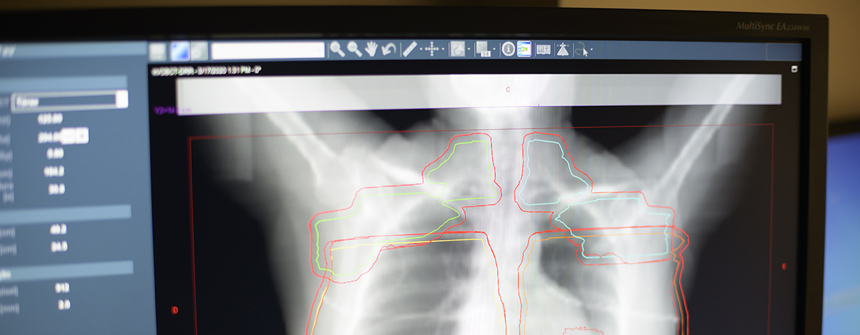 ONCOCLÍNICAS RADIOTERAPIA BOTAFOGO
