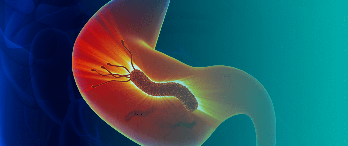 Research and treatment to eradicate H. pylori are effective in reducing the risk of gastric cancer