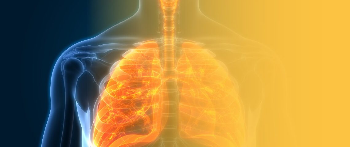 Un estudio multicéntrico evalúa la ablación por microondas con quimioterapia en el cáncer de pulmón no microcítico