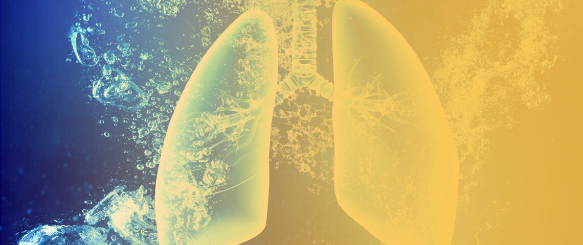 Un estudio muestra la ventaja de Lorlatinib en primera línea para los pacientes de cáncer de pulmón con ALK mutado