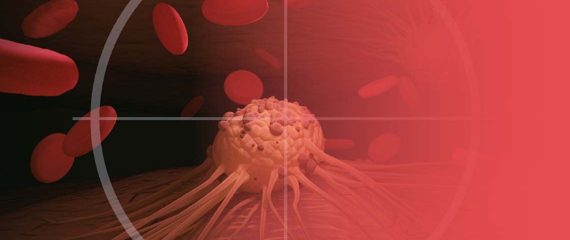 El estudio Chronos-3 señala que la combinación de copanlisib y rituximab aumenta la supervivencia libre de progresión en pacientes con linfoma no Hodgkin indolente