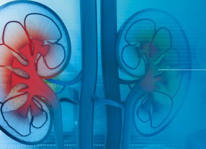 Novos dados do estudo CLEAR avaliaram os desfechos com imunoterápicos sobre a qualidade de vida em pacientes com câncer renal avançado