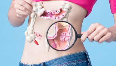 Sintomas do câncer colorretal incluem perda de peso e inchaço no abdome