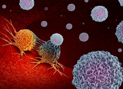 Terapia-alvo para alterações raras em câncer pancreato-biliar: