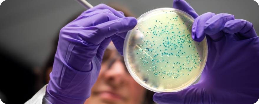 Especialista de laboratório com luvas roxas e placa de Petri na mão esquerda.