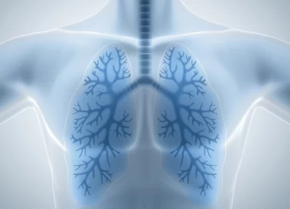 Germline Testing Recommendation (GTR) in Non Small Cell Lung Cancer (NSCLC) after Broad Tumor Sequencing